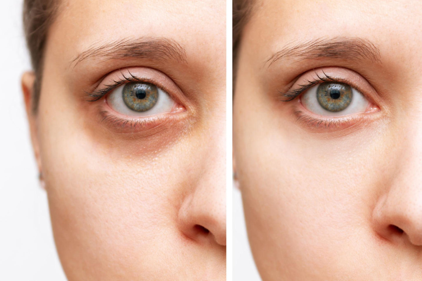 👁️ ¡Mirada luminosa en minutos - adiós ojeras sin salir de casa!